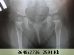 �������� ����� - 48