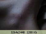 �������� ����� - 135